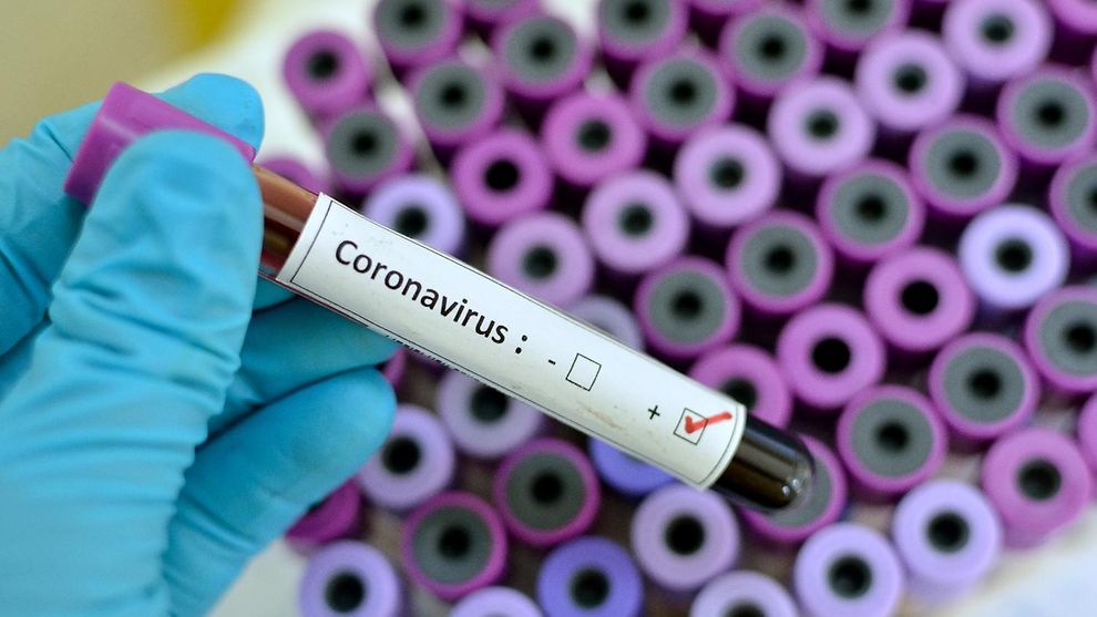 В Украине заболеваемость COVID возросла в шесть раз — Кузин В Украине заболеваемость COVID возросла в шесть раз — Кузин