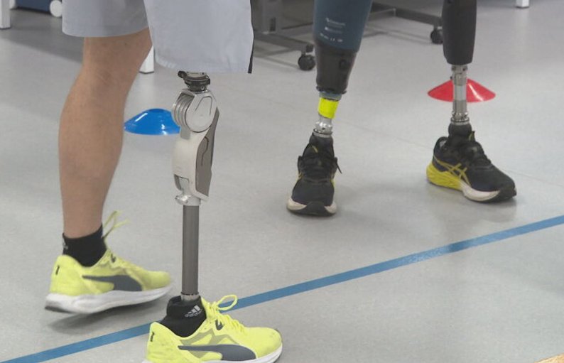 Free Prosthetics Program for War Victims Launched in Kyiv